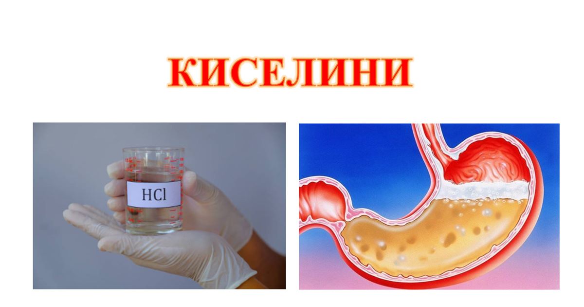 Киселини